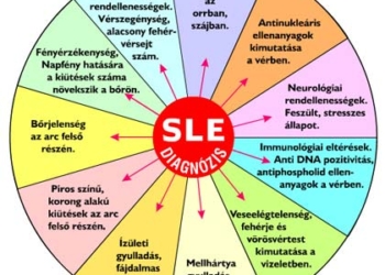Tudj meg többet a lupus (SLE) betegségről!