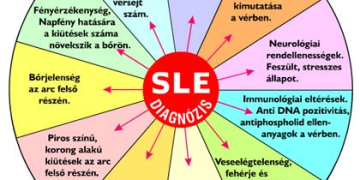 Tudj meg többet a lupus (SLE) betegségről!
