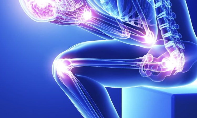 A szisztémás lupus erythematosus (SLE) mozgásszervi panaszai, tünetei és ezek kezelési lehetőségei
